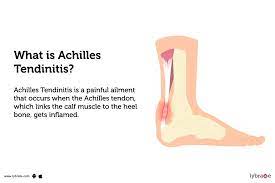 Running Shoes are Best for Achilles Tendonitis